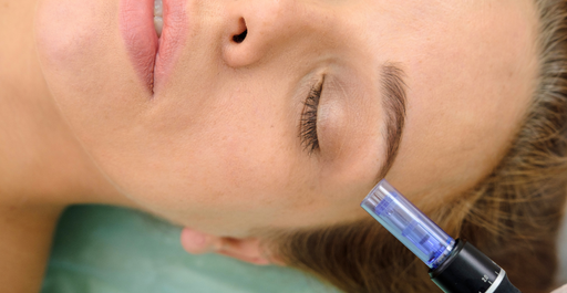 Microneedling at The Filling Station med spa in Denton TX