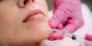 Injecting dermal fillers in Denton at The Filling Station